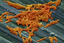 Hình dạng loại siêu vi khuẩn kháng thuốc có tên Clostridium difficile dưới kính hiển vi đã được phát hiện ở châu Âu gần đây. (Ảnh: khoahoc.com.vn)
