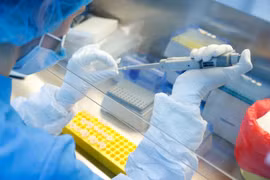 Dịch COVID-19: Iran sản xuất lô thử nghiệm vaccine Sputnik V 