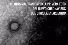 Hình ảnh virus SARS-CoV-2 mà các nhà khoa học Argentina chụp được. (Nguồn: pagina12.com.ar)