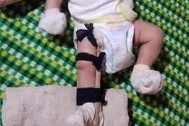 [Video] Tình tiết mới nghi án bé trai 2 tháng bị cha đánh gãy chân