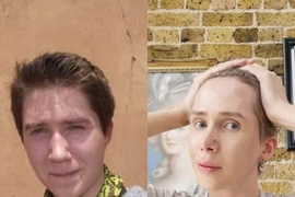 Người đàn ông Anh quốc phẫu thuật cho mình giống thần tượng K-pop