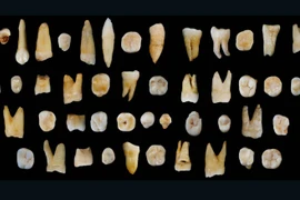 Những chiếc răng khai quật được. (Nguồn: cnn.com)