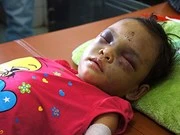 [Video] Phẫn nộ vụ bé gái 4 tuổi bị đánh xuất huyết não