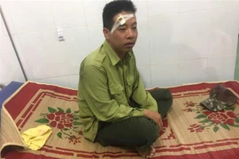 Anh Ngô Lê Nhật Tiến, Trạm phó Trạm Kiểm lâm số 7 bị đối tượng dùng gậy đánh vào vùng mặt, được điều trị tại Trung tâm Y tế huyện Ea Súp. (Ảnh: TTXVN)