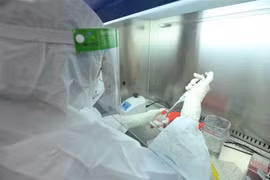 Thực hiện xét nghiệm khẳng định SARS-CoV-2 bằng phương pháp RT-PCR tại Yên Bái. (Nguồn: TTXVN)