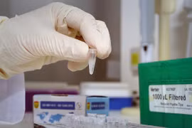 Xét nghiệm xác định virus SARS-CoV-2. (Ảnh: Dương Giang/TTXVN)