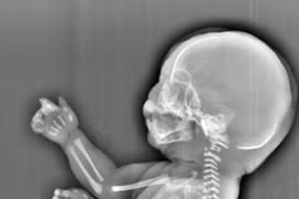 Bà mẹ trẻ đau lòng khi thấy hình ảnh về thai nhi. (Nguồn: CEN)