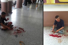 Hai hành khách bị thương sau vụ nổ bom. (Nguồn: bangkokpost.com)