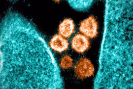 Hình ảnh virus SARS-CoV-2 chụp qua kính hiển vi điện tử. (Ảnh: AFP/TTXVN)