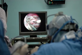 Lai Châu: Phát hiện, phẫu thuật sớm cho trẻ bị tim bẩm sinh