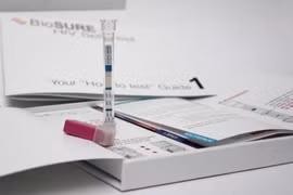 Bộ dụng cụ tự xét nghiệm HIV có độ chính xác gần 100%