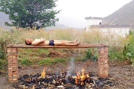 Tự "nướng" - cách chữa trị ung thư độc đáo của chàng trai 25 tuổi