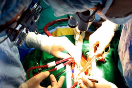 Bệnh viện Bạch Long Vỹ cứu sống bệnh nhân viêm ruột nặng