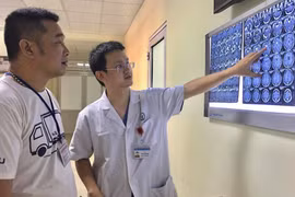 Bác sỹ kiểm tra phim chụp cho người bệnh. (Nguồn: Bệnh viện Hữu nghị Việt Đức)
