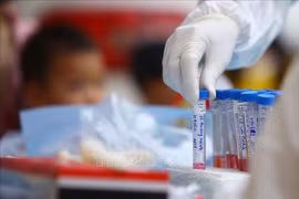 Sai phạm trong hoạt động đấu thầu của CDC Hà Nội đã gây hậu quả nghiêm trọng. (Ảnh: TTXVN)