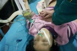 Các bác sỹ đang cấp cứu cho Ngọc Ngọc. (Nguồn: Chinadaily)