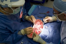 Ảnh minh họa. (Nguồn: oregonlive.com)