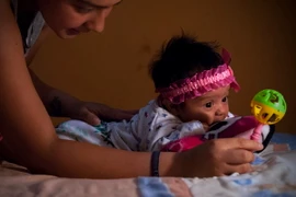 Em bé bị mắc chứng đầu nhỏ tại thủ đô Quito, Ecuador. (Nguồn: THX/TTXVN) 