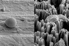 Nghiên cứu mới giúp ngăn chặn nhiễm trùng sau phẫu thuật cấy ghép