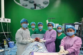 Êkíp phẫu thuật thành công khối u tuyến giáp khổng lồ nặng 1,5kg. (Ảnh: TTXVN phát)