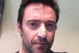 “Người sói” Hugh Jackman phải điều trị ung thư da