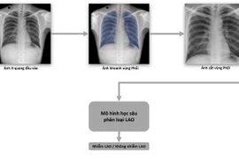Quy trình dạy máy phân loại bệnh Lao. (Nguồn: Vingroup)