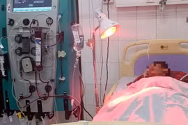 Bệnh nhân N.V.L được chẩn đoán ngộ độc methanol và được điều trị lọc máu tại Bệnh viện Đa khoa tỉnh Cà Mau. (Ảnh: TTXVN phát)