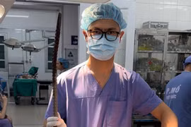 Thanh xà beng nạn nhân bị đâm trúng. (Nguồn: Bệnh viện cung cấp)