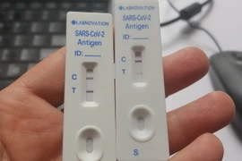 Kết quả xét nghiệm COVID-19. (Nguồn: Vietnam+)
