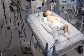 Bé gái gần 3 tháng tuổi nghi bị bạo hành. (Nguồn: Pháp luật Thành phố Hồ Chí Minh)