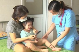 Bệnh tay chân miệng lây nhiễm qua đường tiêu hóa, tập trung ở độ tuổi dưới 5 tuổi. (Ảnh: Hải Yến/TTXVN)