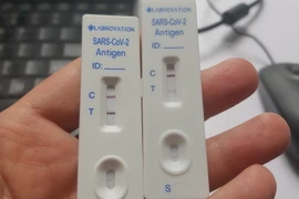 Kết quả xét nghiệm COVID-19. (Nguồn: Vietnam+)