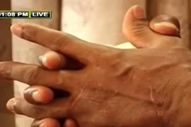 Một giáo sư bị chặt tay vì đưa tên Mohammed vào bài kiểm tra