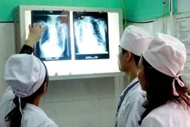 10% người Việt bị phổi tắc nghẽn mạn tính, hen phế quản