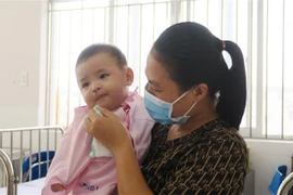 Một bệnh nhi mắc dị tật khe hở môi-vòm đã được phẫu thuật miễn phí tại Bệnh viện Nhi đồng 1. (Ảnh: Đinh Hằng/TTXVN)
