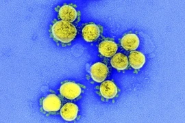 Những triệu chứng thường xuất hiện khi nhiễm biến thể Omicron