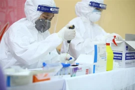 Xét nghiệm nhanh virus SARS-CoV-2. (Ảnh minh họa: TTXVN)