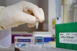 Test xác định virus SARS-CoV-2. (Ảnh: Dương Giang/TTXVN)