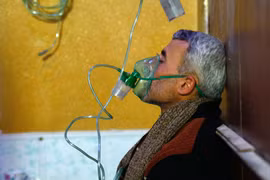 Người dân Syria được điều trị triệu chứng khó thở sau một vụ tấn công được cho là sử dụng vũ khí hóa học ở Douma (Syria). (Nguồn: AFP/ TTXVN)