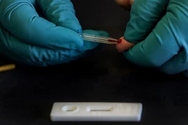 Kỹ thuật viên thử nghiệm bộ xét nghiệm phát hiện nhanh kháng thể chống virus SARS-CoV-2 gây dịch COVID-19 do Công ty công nghệ sinh học ZenTech sản xuất, tại Lieges (Bỉ) ngày 20/4/2020. (Nguồn: AFP/TTXVN) 
