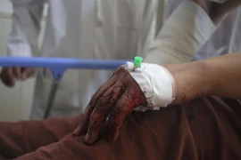 Nhân viên y tế bị thương trong vụ tấn công tại Jalalabad, tỉnh Nangarhar, Afghanistan, ngày 15/6/2021. (Nguồn: THX/TTXVN) 