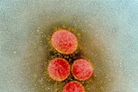 Hình ảnh từ kính hiển vi do Viện Y tế quốc gia Mỹ cung cấp cho thấy virus SARS-CoV-2 trong mẫu bệnh phẩm của bệnh nhân mắc COVID-19 ở Mỹ. (Ảnh: AFP/TTXVN) 