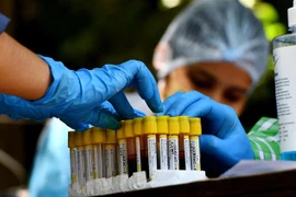 Nhân viên y tế sắp xếp mẫu máu để xét nghiệm COVID-19 tại New Delhi, Ấn Độ, ngày 6/8/2020. (Nguồn: THX/TTXVN) 