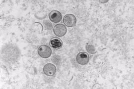Hình ảnh virus đậu mùa khỉ dưới kính hiển vi điện tử tại phòng thí nghiệm thuộc Viện nghiên cứu và kiểm soát bệnh truyền nhiễm Robert Koch của Đức, ngày 23/5/2022. (Ảnh: AFP/TTXVN) 
