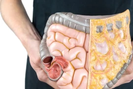 Ảnh minh họa. (Nguồn: switchnutrition.com.au) 