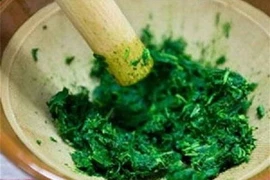 Nhiễm trùng nặng, hoại tử hai đùi do tự đắp thuốc lá chữa bỏng