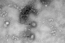 Virus corona mới, được cho là nguyên nhân gây ra dịch viêm phổi lạ tại Vũ Hán, Trung Quốc. (Nguồn: Yonhap/TTXVN) 