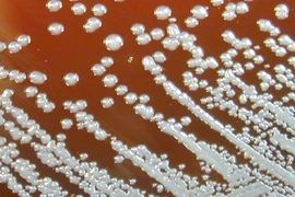 Vi khuẩn B.pseudomallei gây bệnh Whitmore. (Nguồn: CNN) 