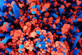 Hình ảnh quét qua kính hiển vi điện tử cho thấy tế bào (màu xanh) bị virus SARS-COV-2 (màu đỏ) xâm nhập. (Ảnh: AFP/TTXVN) 