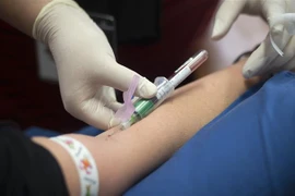 Lấy máu xét nghiệm COVID-19 cho người dân tại Cape Town, Nam Phi ngày 4/5/2020. (Nguồn: AFP/TTXVN) 